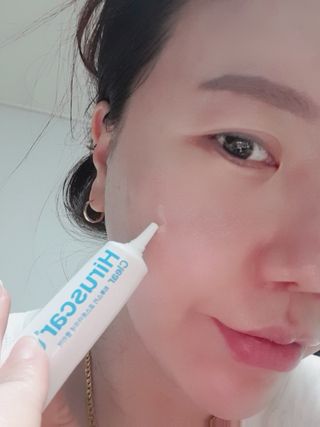 히루스카 포스트아크네 클리어 — 5점을 준 리뷰어가 2021년 2월 올린 사용 사진