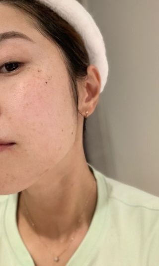 스킨1004 [SKIN1004] 마다가스카르 센텔라 라이트 클렌징 오일 200ml — 5점을 준 리뷰어가 2024년 7월 올린 사용 사진