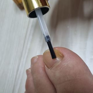 유케어 YOU CARE 문제성 손발톱케어_럭키풋 — 5점을 준 리뷰어가 2022년 9월 올린 사용 사진