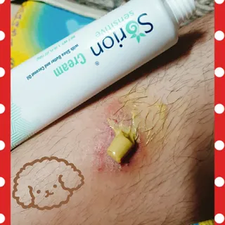 건선/아토/습진/민감성 피부 천연보습진정크림 소리온 크림 & 센시티브 크림 50g — 5점을 준 리뷰어가 2022년 1월 올린 사용 사진