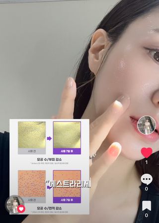 틱톡 캠페인 ★ ｜ Tiktok x 0.8L 에스트라리제덤 (최종_방문형) — 5점을 준 리뷰어가 2024년 10월 올린 사용 사진