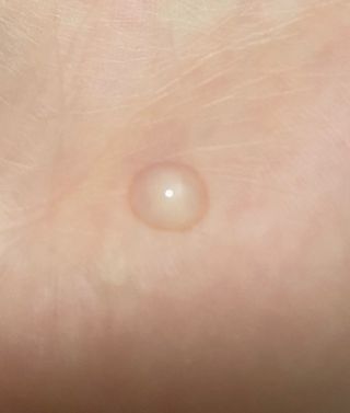 체르엠 스템앤셀 비타민 브라이트닝 에센스 30ml 1개 — 4.5점을 준 리뷰어가 2021년 10월 올린 사용 사진