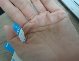 히루스카 포스트아크네 클리어 — 4점을 준 리뷰어가 2020년 12월 올린 사용 사진