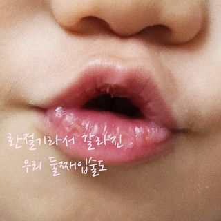 스킨큐어 바람의섬  동백 안티 링클 멀티밤 — 5점을 준 리뷰어가 2022년 11월 올린 사용 사진