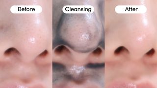 듀오코리아 [듀오] 피부맞춤형 저자극 클렌징밤 1종 랜덤발송 (모공케어,안색개선,안티에이징,블랙헤드) — 5점을 준 리뷰어가 2022년 8월 올린 사용 사진