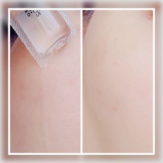 유니베르소 산소앰플 7일 집중케어 앰플 — 3점을 준 리뷰어가 2021년 4월 올린 사용 사진