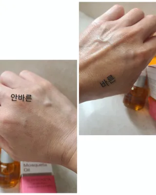 유니베르소 로즈힙 오일 15ml — 5점을 준 리뷰어가 2021년 7월 올린 사용 사진