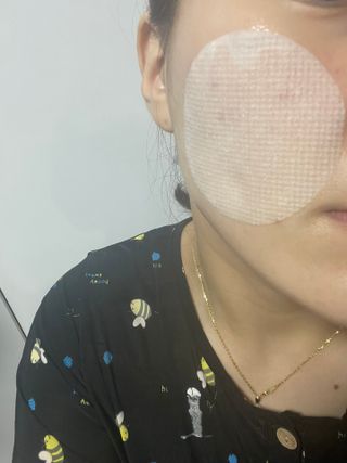 디에이브 더마-테카 바이옴 카밍패드 60매 — 5점을 준 리뷰어가 2022년 11월 올린 사용 사진