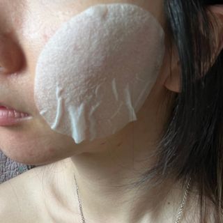 랑벨 랑바이오 블랙 시카 퀵 패드 100매 (3초 쿨링/3분 흡수, 블랙비 프로폴리스/시카 4종 함유, 대용량) — 5점을 준 리뷰어가 2022년 7월 올린 사용 사진