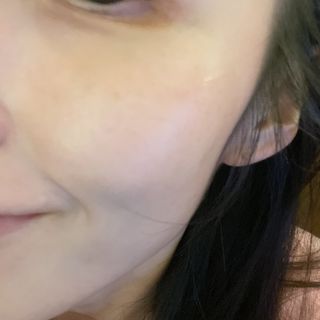 메타포레 12PM 안티블래미쉬 세럼 — 5점을 준 리뷰어가 2021년 8월 올린 사용 사진