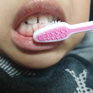 치과에서 쓰는 치약 _ 라벨제로 저불소 꼬마, 키즈, 유아, 베이비, 주니어 안전한 어린이치약 — 5점을 준 리뷰어가 2022년 12월 올린 사용 사진