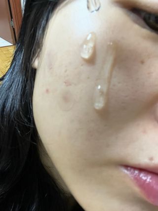 나우 [리브엠] 화해 1등 수분앰플 , 엑소코어 워터풀 텐션 앰플 — 5점을 준 리뷰어가 2024년 12월 올린 사용 사진