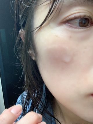 나우 [리브엠] 123억개 엑소좀으로 채운 눈부신 광채, 엑소코어 화이트닝 텐션 앰플 — 5점을 준 리뷰어가 2023년 9월 올린 사용 사진