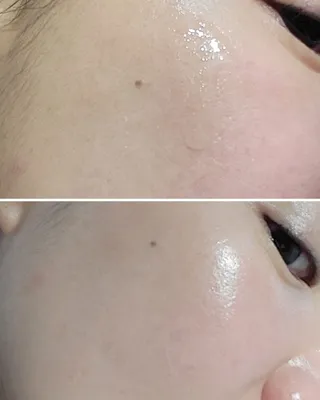 산다화 더블 이펙트 안티 링클 세럼 50ml — 5점을 준 리뷰어가 2022년 10월 올린 사용 사진