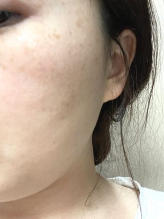 팜스테이 티트리 바이옴 카밍 아크네 폼 — 5점을 준 리뷰어가 2022년 4월 올린 사용 사진