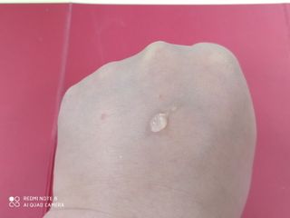 브에노 스킨셀 더마 앰플 — 5점을 준 리뷰어가 2021년 6월 올린 사용 사진