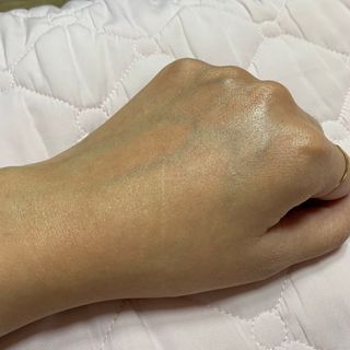바이오오일 [바이오-오일] 바디 로션 175ml — 4점을 준 리뷰어가 2021년 11월 올린 사용 사진