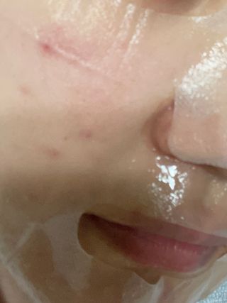 체르엠 그린 케비어 더블워터 마스크팩 5매입  2팩 — 5점을 준 리뷰어가 2021년 12월 올린 사용 사진