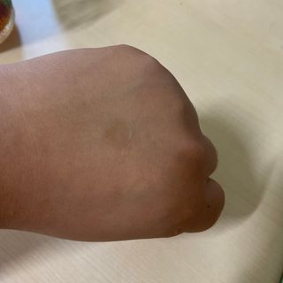 올리브영 엘라밴드 하이드로 도트 스팟패치 12mm, 티트리 — 5점을 준 리뷰어가 2022년 9월 올린 사용 사진
