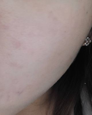 [후르디아] 주름 개선 기능성-석류 크림 미스트 — 5점을 준 리뷰어가 2021년 2월 올린 사용 사진