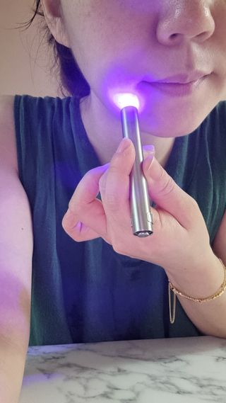 메데스 비츠케어 모공케어 피부관리키트 — 4점을 준 리뷰어가 2021년 8월 올린 사용 사진