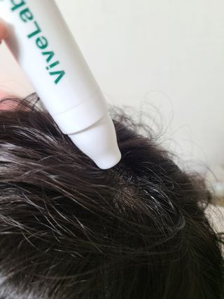 바이브랩 [탈모증상완화] 헤어라인 눈썹 두피앰플 — 5점을 준 리뷰어가 2022년 3월 올린 사용 사진