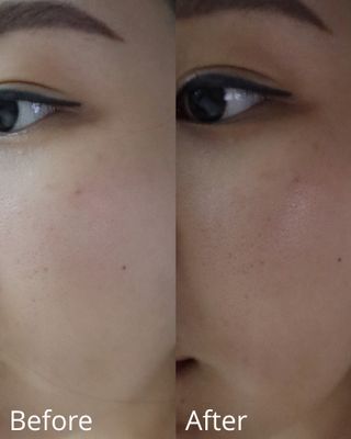 플레라디 에델바이스 오일 밸런싱 토너 — 5점을 준 리뷰어가 2021년 7월 올린 사용 사진