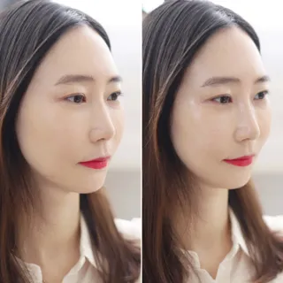 랑벨 비타 에너지 잡티 앰플 50ml 고농축 비타민, 저자극, 수분 촉촉, 미백 앰플 — 5점을 준 리뷰어가 2022년 3월 올린 사용 사진