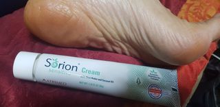 건선/아토/습진/민감성 피부 천연보습진정크림 소리온 크림 & 센시티브 크림 50g — 5점을 준 리뷰어가 2022년 1월 올린 사용 사진