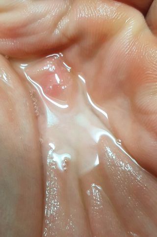 모두발라 탈모집중케어 앰플 트리트먼트 — 5점을 준 리뷰어가 2022년 3월 올린 사용 사진