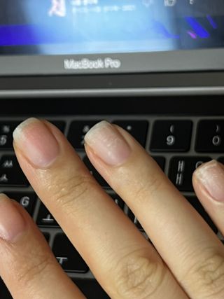 뷰젤 매직케어 네일솔루션 손발톱 보습 영양제 펜슬타입 5ml — 5점을 준 리뷰어가 2022년 3월 올린 사용 사진