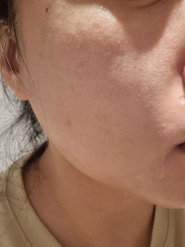 📷프리 (인스타체험단) [밀리밀리] 메디 앰플 비타 15ml 리뷰 사진