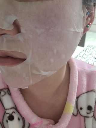 큐템 레이저 마스크 — 5점을 준 리뷰어가 2021년 1월 올린 사용 사진