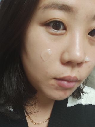냉장고에 넣어요, 붉은 트러블 피부 다음날 진정되요 [버진팜스 푸딩수딩아토] — 5점을 준 리뷰어가 2021년 9월 올린 사용 사진