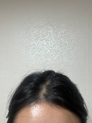 닥터시드 페퍼민트 앤 레몬 비건 비듬케어 쿨 탈모 샴푸 (1000ml) — 5점을 준 리뷰어가 2024년 2월 올린 사용 사진