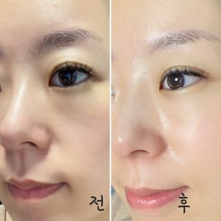리더스코스메틱 리더스 카밍 바이오틱스 퀵 수딩 패드 — 4.5점을 준 리뷰어가 2022년 8월 올린 사용 사진