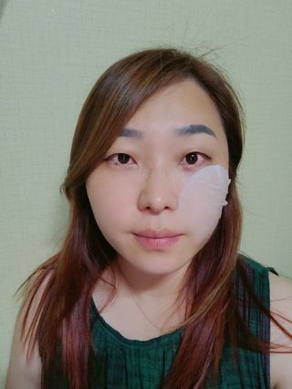 랑벨 랑바이오 블랙 시카 퀵 패드 100매 (3초 쿨링/3분 흡수, 블랙비 프로폴리스/시카 4종 함유, 대용량) — 5점을 준 리뷰어가 2022년 7월 올린 사용 사진