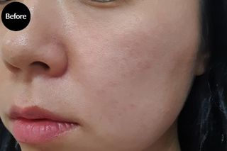 [유니자르] COSDIY    디톡 주스 토너 + 칼라민 파우터 7포 + 알란토인 파우더 7포 — 5점을 준 리뷰어가 2021년 11월 올린 사용 사진
