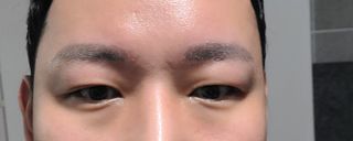 바이브랩 [탈모증상완화] 헤어라인 눈썹 두피앰플 — 4점을 준 리뷰어가 2022년 3월 올린 사용 사진