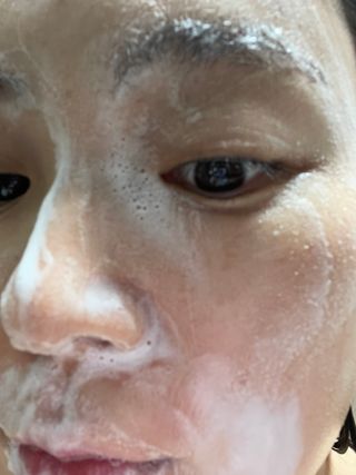 팜스테이 티트리 바이옴 카밍 아크네 폼 — 4.5점을 준 리뷰어가 2022년 7월 올린 사용 사진