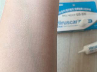 히루스카 포스트아크네 클리어 — 4.5점을 준 리뷰어가 2021년 1월 올린 사용 사진