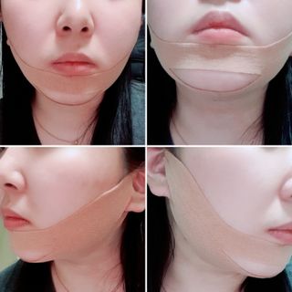 아이디플라코스메틱 아이디 페이스핏 마이너스 밴드 v2 — 4점을 준 리뷰어가 2021년 5월 올린 사용 사진