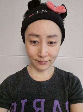 웰더마 프리미엄 PDRN 엑소좀 하이드로겔 피팅 마스크 1박스(4매입) — 4.5점을 준 리뷰어가 2025년 5월 올린 사용 사진