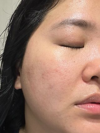 [스킨1004] 마다가스카르 센텔라 앰플 100ml — 5점을 준 리뷰어가 2024년 5월 올린 사용 사진
