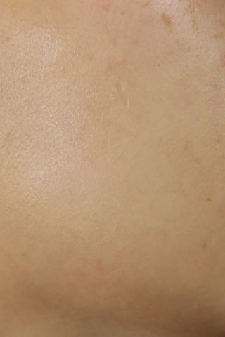 [후르디아] 민감피부 수분크림 비건 아보카도 크림 — 5점을 준 리뷰어가 2022년 1월 올린 사용 사진