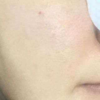 랑벨 비타 에너지 잡티 앰플 패드 65매 (투명하고 밝은 얼굴 광채패드) — 4점을 준 리뷰어가 2022년 6월 올린 사용 사진
