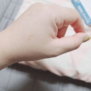 히루스카 포스트아크네 클리어 — 5점을 준 리뷰어가 2021년 2월 올린 사용 사진