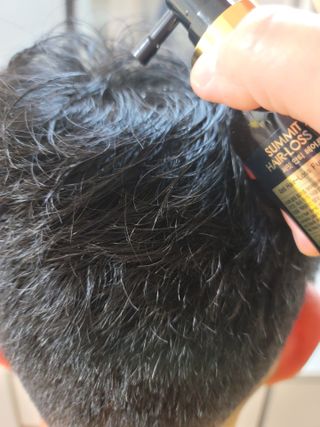 썸헤어 / SUMHAIR 썸헤어 써밋 안티 헤어로스 토닉 — 5점을 준 리뷰어가 2021년 5월 올린 사용 사진