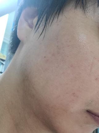 [스킨1004] 마다가스카르 센텔라 앰플 100ml — 5점을 준 리뷰어가 2024년 6월 올린 사용 사진
