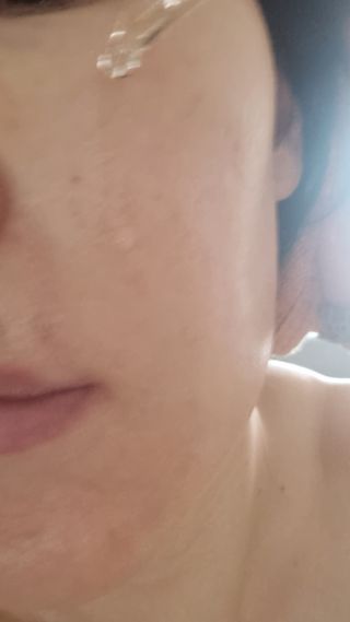 [스킨1004] 마다가스카르 센텔라 앰플 100ml — 5점을 준 리뷰어가 2024년 6월 올린 사용 사진